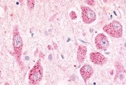 GPR26 Polyclonal Antibody, Invitrogen 25 &mu;g | Buy Online | Thermo Scientific | Fisher Scientific