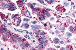 Invitrogen GPR4 Polyclonal Antibody 25 &mu;g | Buy Online | Invitrogen&trade; | Fisher Scientific