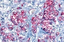 Invitrogen GPR43 Polyclonal Antibody 25 &mu;g | Buy Online | Invitrogen&trade; | Fisher Scientific