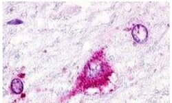 GPR22 Polyclonal Antibody, Invitrogen 25 &mu;g | Buy Online | Thermo Scientific | Fisher Scientific