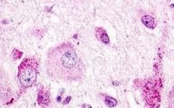 GPR22 Polyclonal Antibody, Invitrogen 25 &mu;g | Buy Online | Thermo Scientific | Fisher Scientific