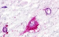 GPR22 Polyclonal Antibody, Invitrogen 25 &mu;g | Buy Online | Thermo Scientific | Fisher Scientific