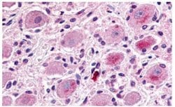 Invitrogen MRGPRX1 Polyclonal Antibody 25 &mu;g; Unconjugated:Antibodies,
