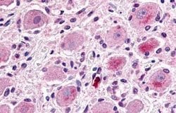 Invitrogen MRGPRX1 Polyclonal Antibody 25 &mu;g; Unconjugated:Antibodies,