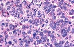 Invitrogen MRGPRX1 Polyclonal Antibody 25 &mu;g; Unconjugated:Antibodies,