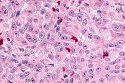 Invitrogen MRGPRX1 Polyclonal Antibody 25 &mu;g; Unconjugated:Antibodies,