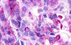 GALR3 Polyclonal Antibody, Invitrogen 25 &mu;g | Buy Online | Invitrogen | Fisher Scientific