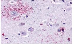 Invitrogen MAS1 Polyclonal Antibody 25 &mu;g; Unconjugated:Antibodies,