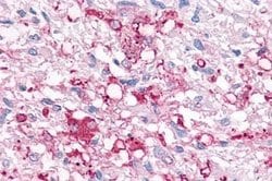 Invitrogen P2Y6 Polyclonal Antibody 25 &mu;g; Unconjugated:Anticuerpos