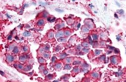 Invitrogen P2Y6 Polyclonal Antibody 25 &mu;g; Unconjugated:Anticuerpos