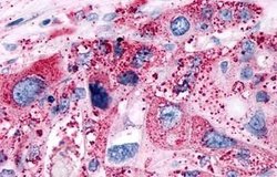 Invitrogen P2Y6 Polyclonal Antibody 25 &mu;g; Unconjugated:Anticuerpos