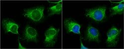 Invitrogen TNIK Polyclonal Antibody 25 &mu;L; Unconjugated:Antibodies,