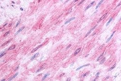 Invitrogen HTR1B Polyclonal Antibody 25 &mu;g; Unconjugated:Antibodies,