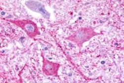 P2Y8 Polyclonal Antibody, Invitrogen 25 &mu;g; Unconjugated:Antibodies,