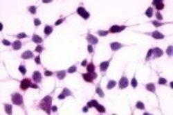 Invitrogen RAI3 Polyclonal Antibody 25 &mu;g | Buy Online | Invitrogen&trade; | Fisher Scientific