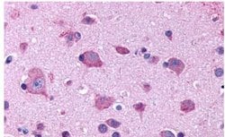 Invitrogen&trade;&nbsp;HTR2B Polyclonal Antibody