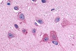 Invitrogen&trade;&nbsp;HTR2B Polyclonal Antibody