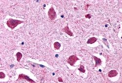 Invitrogen&trade;&nbsp;HTR2B Polyclonal Antibody