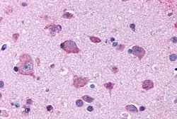 Invitrogen&trade;&nbsp;HTR2B Polyclonal Antibody
