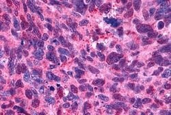 Invitrogen&trade;&nbsp;HTR2B Polyclonal Antibody