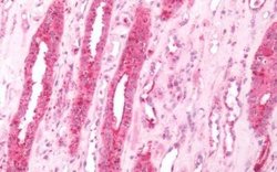 beta-3 Adrenergic Receptor Polyclonal Antibody, Invitrogen 25 &mu;g | Buy Online | Thermo Scientific | Fisher Scientific