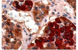GHRHR Polyclonal Antibody, Invitrogen 25 &mu;g | Buy Online | Thermo Fisher Scientific | Fisher Scientific