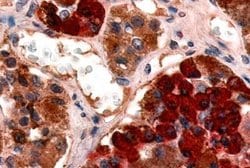 GHRHR Polyclonal Antibody, Invitrogen&trade;