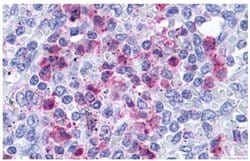 LTB4R Polyclonal Antibody, Invitrogen 25 &mu;g; Unconjugated:Antibodies,