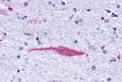 LTB4R Polyclonal Antibody, Invitrogen 25 &mu;g; Unconjugated:Antibodies,