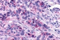 LTB4R Polyclonal Antibody, Invitrogen 25 &mu;g; Unconjugated:Antibodies,