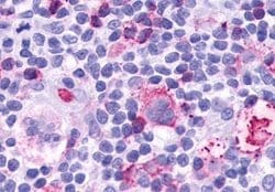LTB4R Polyclonal Antibody, Invitrogen 25 &mu;g; Unconjugated:Antibodies,