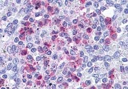 LTB4R Polyclonal Antibody, Invitrogen 25 &mu;g; Unconjugated:Antibodies,