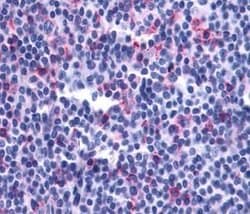 Invitrogen LTB4R2 Polyclonal Antibody 25 &mu;g; Unconjugated:Antibodies,