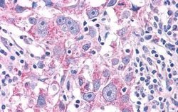 Invitrogen NEK6 Polyclonal Antibody 25 &mu;g; Unconjugated:Antibodies,