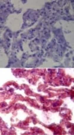 Invitrogen TLR7 Polyclonal Antibody 100 &mu;L; Unconjugated:Antibodies,