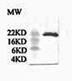 Invitrogen CRP Polyclonal Antibody 50 &mu;g; Unconjugated:Antibodies, Polyclonal