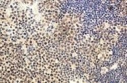 Invitrogen IL-22 Polyclonal Antibody 50 &mu;g; Unconjugated:Antibodies,