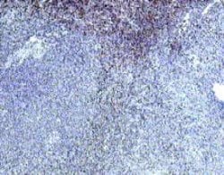 Invitrogen IL-22 Receptor alpha Polyclonal Antibody 100 &mu;g; Unconjugated:Antibodies,