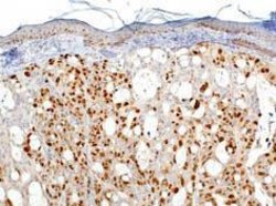 Invitrogen Ki-67 Polyclonal Antibody 500 &mu;L; Unconjugated:Antibodies,