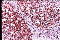 Invitrogen Ki-67 Polyclonal Antibody 500 &mu;L; Unconjugated:Antibodies,