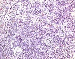 Invitrogen CCR7 Polyclonal Antibody 50 &mu;g; Unconjugated:Antibodies,