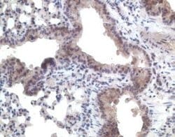 Invitrogen CCR11 Polyclonal Antibody 100 &mu;g | Buy Online | Invitrogen&trade; | Fisher Scientific