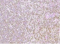 Invitrogen CXCR4 Polyclonal Antibody 100 &mu;g | Buy Online | Invitrogen&trade; | Fisher Scientific