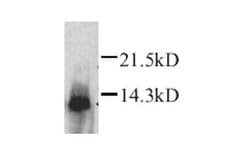 Invitrogen Lymphotactin Polyclonal Antibody 50 &mu;g; Unconjugated:Antibodies,