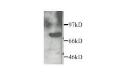 Invitrogen MMP2 Polyclonal Antibody 50 &mu;g | Buy Online | Invitrogen&trade; | Fisher Scientific