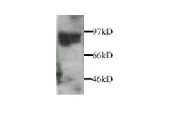 Invitrogen MMP9 Polyclonal Antibody 50 &mu;g; Unconjugated:Antibodies,