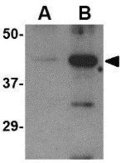 Invitrogen Avian Influenza A HA Polyclonal Antibody 100 &mu;g | Buy Online | Invitrogen&trade; | Fisher Scientific