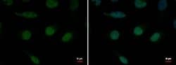 Invitrogen XPB Polyclonal Antibody 50 &mu;g; Unconjugated:Antibodies, Polyclonal