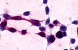 Invitrogen XPR1 Polyclonal Antibody 25 &mu;g; Unconjugated:Antibodies,