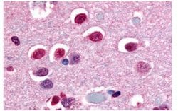 Invitrogen NOR-1 Polyclonal Antibody 25 &mu;g; Unconjugated:Antibodies,